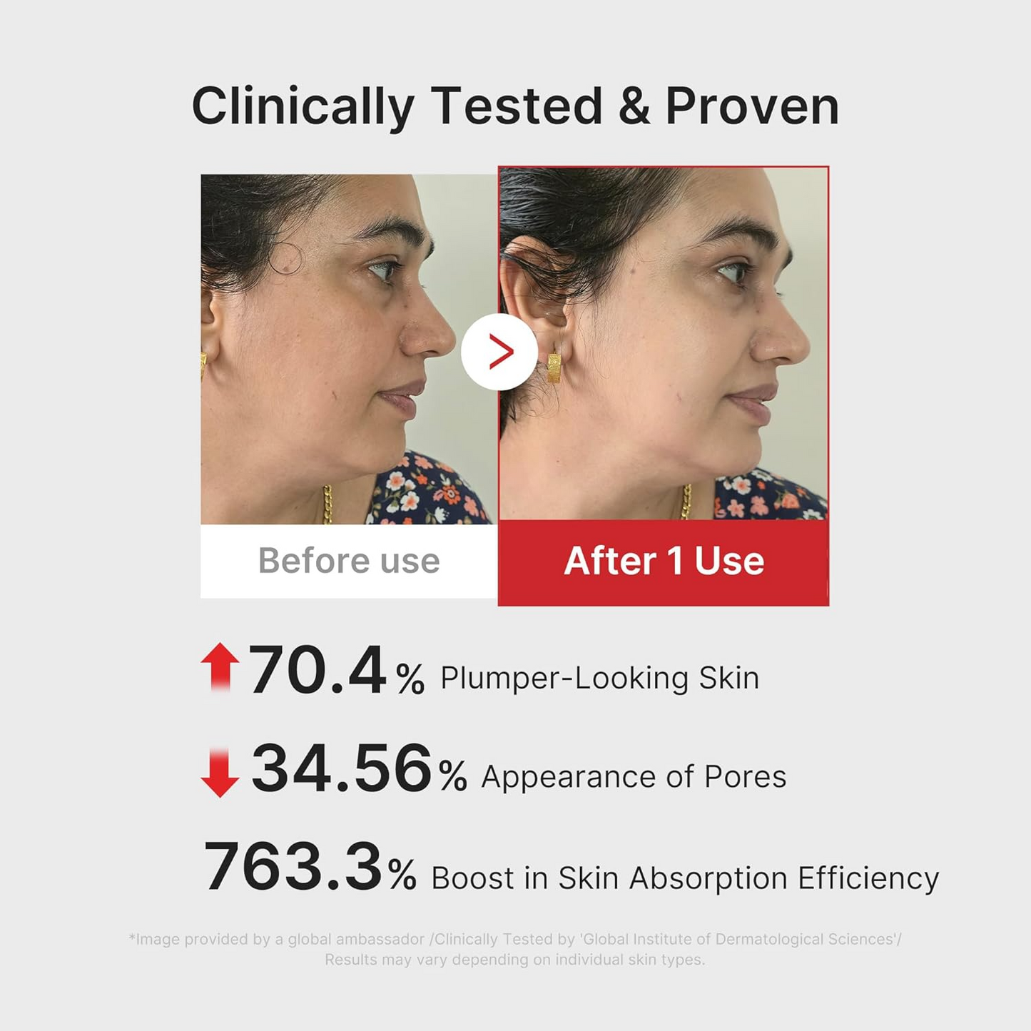 Noria Skin LumiLift™ – Microcurrent Facial Rejuvenation Device | Blush Pink